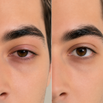 Comparaison de deux photos d'un œil : à gauche un regard fatigué avec des cernes, à droite un regard plus reposé